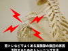 筋トレなどでよくある肩関節の脱臼の原因と予防するためのトレーニング方法